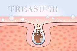 一白遮百丑，长痘毁所有，反复长痘还如何护肤？